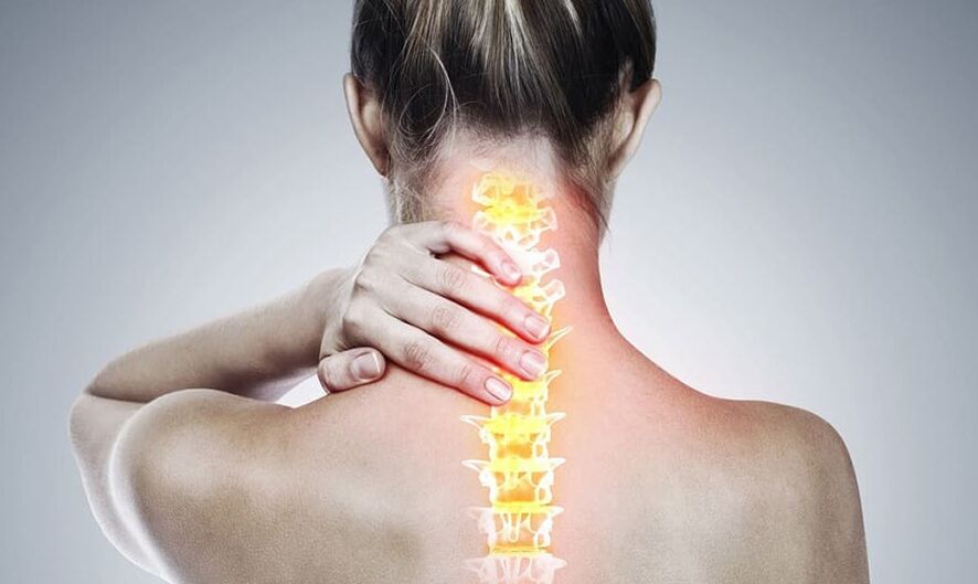 Ostéochondrose de la colonne cervicale