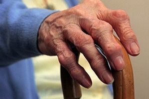 Dommages aux doigts avec arthrose